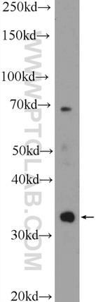 C21orf59 Antibody in Western Blot (WB)