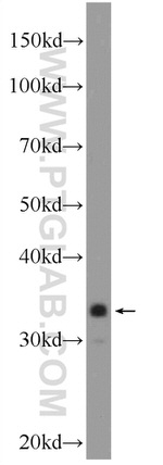 C21orf59 Antibody in Western Blot (WB)