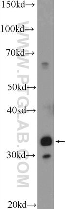 C21orf59 Antibody in Western Blot (WB)