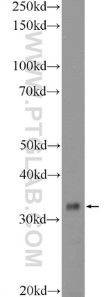 C21orf59 Antibody in Western Blot (WB)