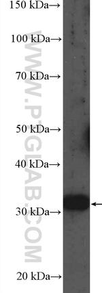 MMACHC Antibody in Western Blot (WB)