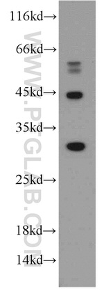 MMACHC Antibody in Western Blot (WB)
