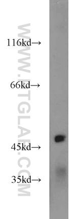 IGSF21 Antibody in Western Blot (WB)