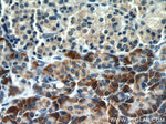TMEM230 Antibody in Immunohistochemistry (Paraffin) (IHC (P))