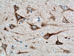 TMEM230 Antibody in Immunohistochemistry (Paraffin) (IHC (P))