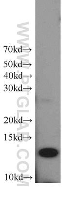 TMEM230 Antibody in Western Blot (WB)