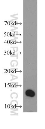 TMEM230 Antibody in Western Blot (WB)