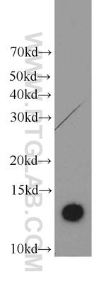 TMEM230 Antibody in Western Blot (WB)