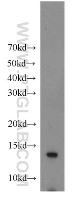 TMEM230 Antibody in Western Blot (WB)