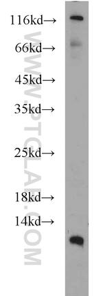 DMRTC1B Antibody in Western Blot (WB)