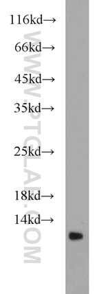 DMRTC1B Antibody in Western Blot (WB)