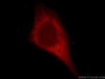 KIAA0513 Antibody in Immunocytochemistry (ICC/IF)