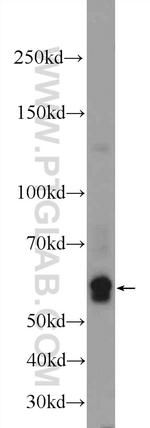 F9 Antibody in Western Blot (WB)