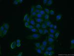 PLP2 Antibody in Immunocytochemistry (ICC/IF)