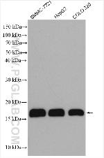 PLP2 Antibody in Western Blot (WB)