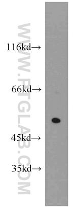 CHIA Antibody in Western Blot (WB)