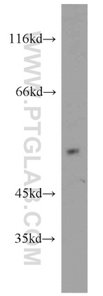 CHIA Antibody in Western Blot (WB)