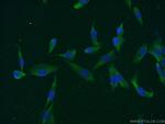 MAGEC3 Antibody in Immunocytochemistry (ICC/IF)