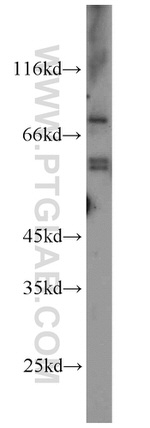 VANGL2 Antibody in Western Blot (WB)