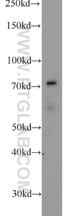 VANGL2 Antibody in Western Blot (WB)