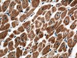 C20orf160 Antibody in Immunohistochemistry (Paraffin) (IHC (P))