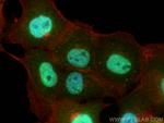 SLITRK5 Antibody in Immunocytochemistry (ICC/IF)