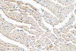 NEBL Antibody in Immunohistochemistry (Paraffin) (IHC (P))