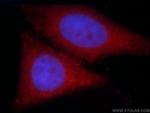 SH3D19 Antibody in Immunocytochemistry (ICC/IF)