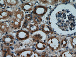 SH3D19 Antibody in Immunohistochemistry (Paraffin) (IHC (P))