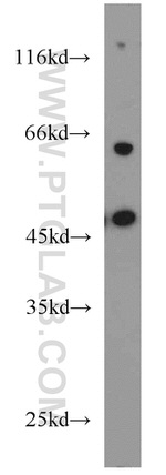 SH3D19 Antibody in Western Blot (WB)