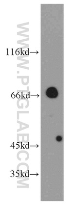 Arp5/ACTR5 Antibody in Western Blot (WB)