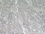 FZD5 Antibody in Immunohistochemistry (Paraffin) (IHC (P))