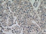 FZD5 Antibody in Immunohistochemistry (Paraffin) (IHC (P))