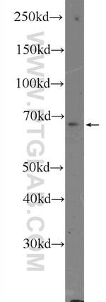 FZD5 Antibody in Western Blot (WB)