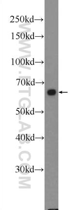 FZD5 Antibody in Western Blot (WB)