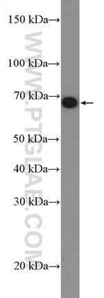 FZD5 Antibody in Western Blot (WB)