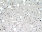 CCT4 Antibody in Immunohistochemistry (Paraffin) (IHC (P))