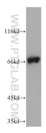 ITK Antibody in Western Blot (WB)