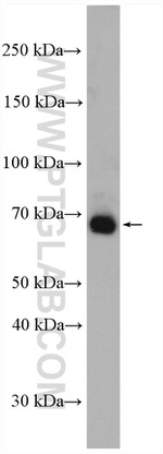 ITK Antibody in Western Blot (WB)