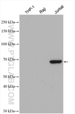 ITK Antibody in Western Blot (WB)