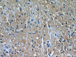 MYLK3 Antibody in Immunohistochemistry (Paraffin) (IHC (P))