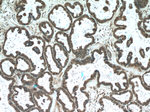 L1TD1 Antibody in Immunohistochemistry (Paraffin) (IHC (P))