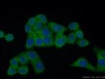 FAM120A Antibody in Immunocytochemistry (ICC/IF)