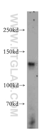FAM120A Antibody in Western Blot (WB)