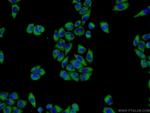 ISM2 Antibody in Immunocytochemistry (ICC/IF)