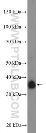 FCGR2B / CD32b Antibody in Western Blot (WB)