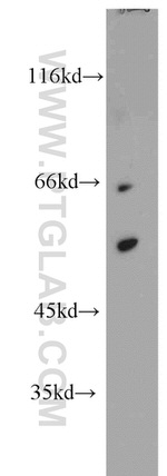 GABPA Antibody in Western Blot (WB)