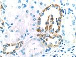 TLL2 Antibody in Immunohistochemistry (Paraffin) (IHC (P))
