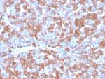 Coagulation Factor VII/F7 Monoclonal Antibody (F7/3515)