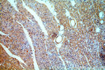 CYP26B1 Antibody in Immunohistochemistry (Paraffin) (IHC (P))